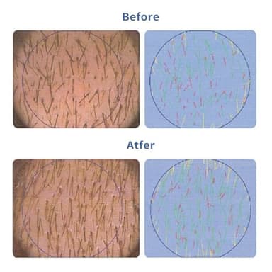 Hair Growth Serum Roll-On 30ml | Patented Blend with 3% Rosemary, 3% Redensyl, 2% AnaGain, Biotin & Niacinamide | No-Rinse, Fast-Absorbing | For Thinning Hair & All Hair Types (1.01 Fl Oz (Pack of 1)) - Image 8