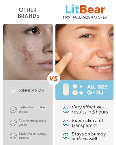 LitBear Large Acne Pimple Patches, 5 Sizes 80 Patches for Large Breakouts, Acne Patches for Face, Chin or Body, Acne Spot Patch with Tea Tree & Calendula Oil, Hydrocolloid Bandages for Acne Skin - Image 3