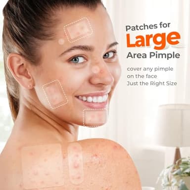 Large Pimple Patches for Face, 7 Sizes Big Acne Patches, XL Hydrocolloid Bandages for Body, Chin, Forehead, Nose, Back Blemish Zit Breakouts, Hydrocolloid Patch (Square, Strip, Dot 142 Count) - Image 3