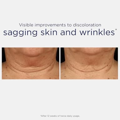 NEOSTRATA Triple Firming Neck Cream, New & Improved Formula - with MicroDiPeptide229®, NeoGlucosamine, and Bakuchiol, Fragrance-free, Oil-Free, Décolletage Rejuvenating Cream For all Skin Types, 80 g. - Image 5