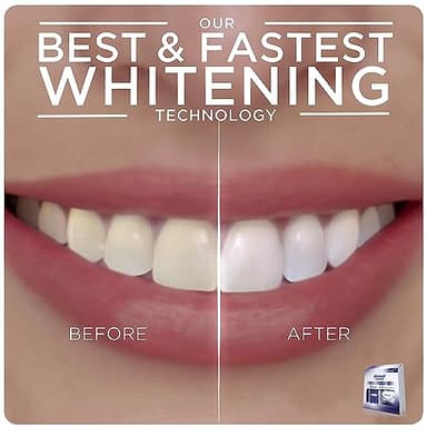 Crest 3D Whitestrips + LED Light – Teeth Whitening Kit, 1 Light + 10 Treatments, Each with 1 Upper/1Lower, 20 Strips – Crest 3DWhite Teeth Whitening Strips - Image 5