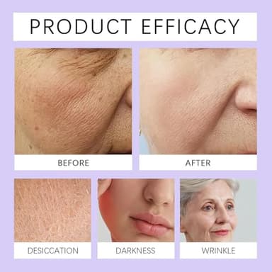 GET-DREAMY Overnight Toning Whip, Advanced Firming & Wrinkle-Reducing Cream, Get Dreamy Body Firming Cream, Restore skin Elasticity, Natural Body firming Oil Suitable for All Skin Types (1 Bottle) - Image 4