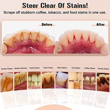 Plaque Remover for Teeth, Electric Tooth Cleaner Tartar Remover for Teeth with LED Light,4 Modes Rechargeable Teeth Cleaning Kit with Dental Tools, 2 Replaceable Heads (White A) - Image 4