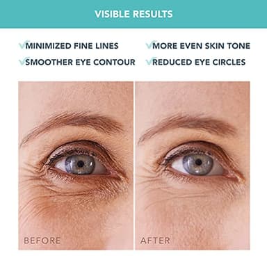 FOREO IRIS Hydrating Hydrogel Eye Mask - Dark Circles Under Eye Treatment for Women & Men - Puffy Eyes Treatment - Hydrating & Refreshing - Vegan - All Skin Types - 60 Under Eye Patches - Image 6
