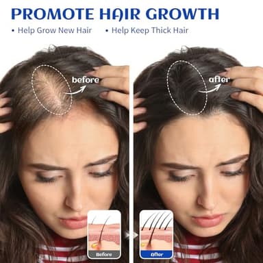 HIQILI Rosemary Oil for Hair Growth, Add to Shampoo & Conditioner, 100% Pure Undiluted - 16 Fl Oz - Image 2