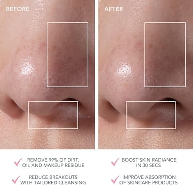 FOREO Luna Mini 3 - Premium Facial Cleansing Brush Bundle - Image 7