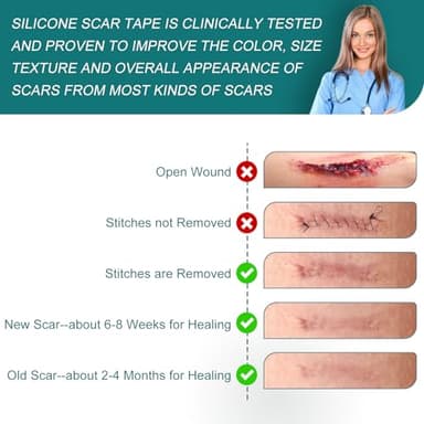 SLUKHIG Silicone Scar Sheets (1.6"x 158" Roll-4M), Silicone Scar Tape for Scar Removal Treatment, Reusable Silicone Scar Strips for C-Section, Keloid, Burn, Acne, Surgical Scars - Image 6