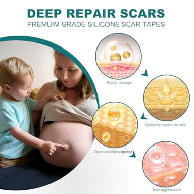 SLUKHIG Silicone Scar Sheets (1.6"x 158" Roll-4M), Silicone Scar Tape for Scar Removal Treatment, Reusable Silicone Scar Strips for C-Section, Keloid, Burn, Acne, Surgical Scars - Image 3