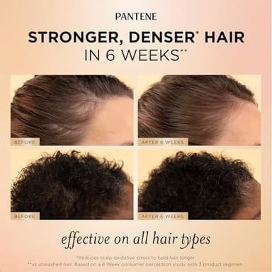 Pantene Abundant & Strong 3-Piece Regimen with B5 Complex + Niacinamide, Shampoo (13.5 oz), Conditioner (8 oz), Serum (2 oz) for Hair Loss, Thinning, Anti-Breakage, Volume - Grows Healthier - Image 5
