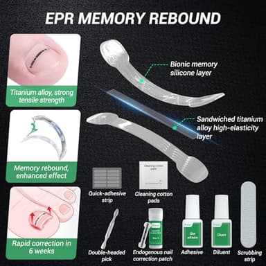 Reieset Titanium Alloy Ingrown Toenail Treatment, Nail Tools, and Ingrown Toenail Removal Kit Specially Designed for Curved Nail Repair and Ingrown Toenail Corrector (0.59/0.67in) - Image 6