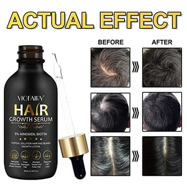PEFAMNE 5% Minoxidil for Men and Women Hair Growth Oil, Biotin Serum, Hair Regrowth Treatment for Scalp Hair Loss, Natural, for Thicker Longer Fuller Healthier Hair 2.02 oz - Image 2