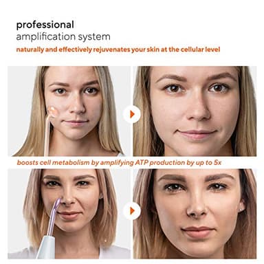 NuDerma Professional Skin Therapy Wand - Portable Skin Therapy Machine with 6 Neon & Argon Wands – Boost Your Skin – Clear Firm & Tighten - Image 5