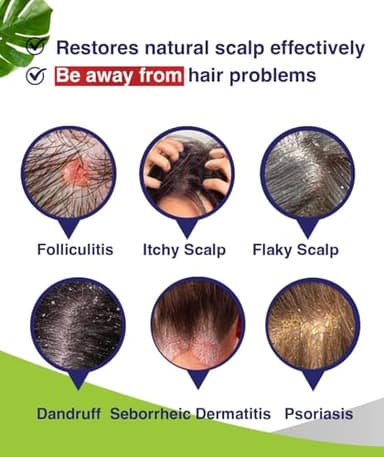 PHARMBANNER Anti-Fungal Shampoo for Folliculitis, Seborrheic Dermatitis, Scalp Psoriasis - Relieves Itchy & Dry Scalp - Image 2
