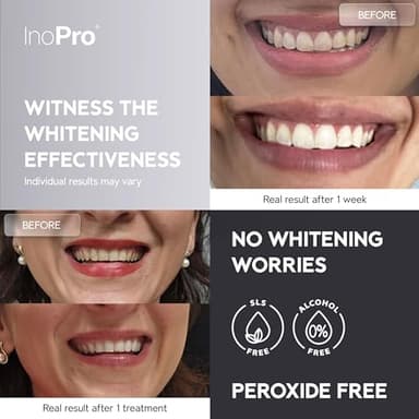 InoPro Natural Teeth Whitening Strips Kit 14 Treatments - Sensitive Teeth Whitener, Peroxide Free with Papain, Bromelain, Coconut Oil, White Strips for Teeth Whitening (28 Strips) - Image 3