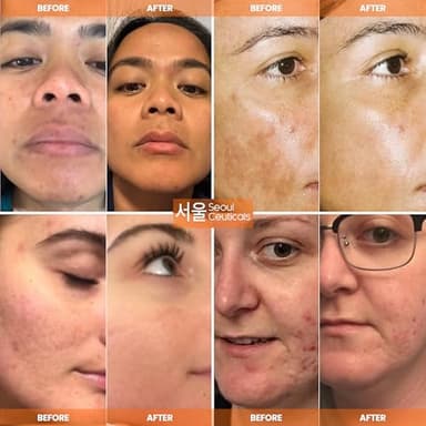 SeoulCeuticals Large 2oz Korean 20% Vitamin C Hyaluronic Acid Serum + CE Ferulic Acid - Potent Anti Aging, Anti Wrinkle K Beauty - Image 3