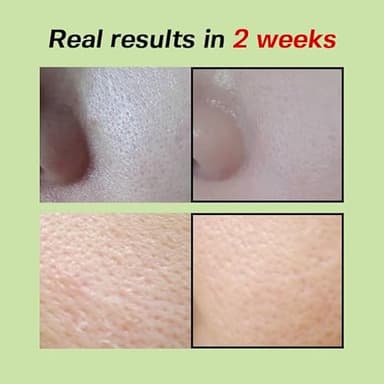 SUNGBOON EDITOR Green Tomato Pore Lifting Ampoule | Pore Minimizer Serum with Niacinamide & Green Tomato Extract | Hydrating & Firming Care for Sensitive Skin | Korean Skincare - Image 6