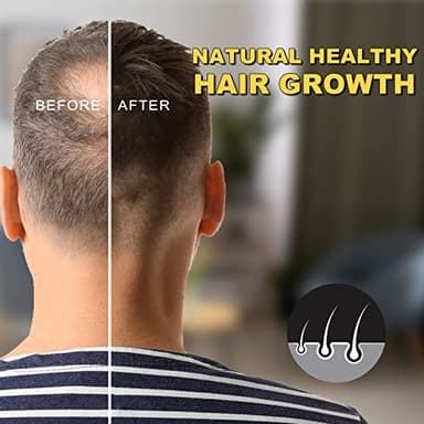 PEFAMNE 5% Minoxidil for Men and Women Hair Growth Oil, Biotin Serum, Hair Regrowth Treatment for Scalp Hair Loss, Natural, for Thicker Longer Fuller Healthier Hair 2.02 oz - Image 5