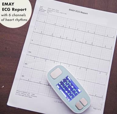 EMAY 6L Portable ECG Monitor | Record ECG and Heart Rate in 6 Channels | Compatible with Smartphone and PC | No Subscription Required - Image 7