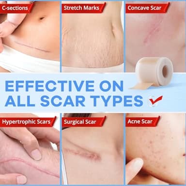 Wifamy Silicone Scar Sheets for Women: Medical Grade Scar Removal C-Section Recovery & Post-Surgery Care (1.6"X 60" Roll-1.5M) - Image 6