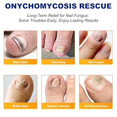 Toenail Fungus Treatment Extra Strength - 32 Pcs Fungal Nail Patches, Nail Repair for Damaged Nails, Overnight Renewal for Men and Women - Image 4