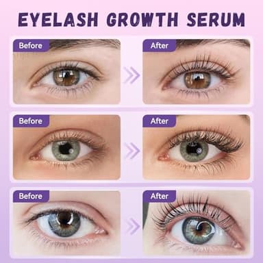 Lash Serum for Eyelash Growth:Natural & Vegan Eyelash Growth Serum for Longer, Thicker, Fuller Lashes Nourishing & Conditioning Formula - Safe for Sensitive Eyes - 5ml - Image 3