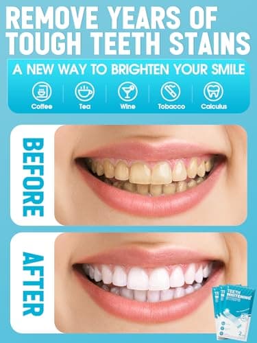 Oralfree Natural Teeth Whitening Strips - Sensitive Teeth Whitener - Enamel Safe Teeth Whitening Kit with Hydrogen Peroxide for Coffee, Wine, Tobacco, and Other Stains, 28 Strips (14 Treatment), Mint - Image 4