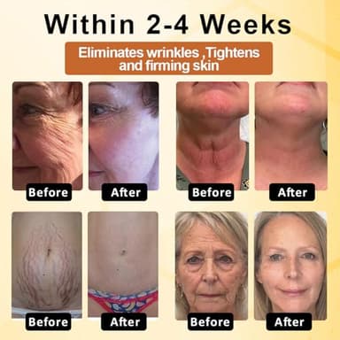 YSMYSM ApisDerm BotoxBee Advanced Multi-Action Firming Cream, Botox Bee Firming Cream, Advanced firming & Wrinkle-Reducing cream, Bee Venom for Tightens Skin (1PC) - Image 6