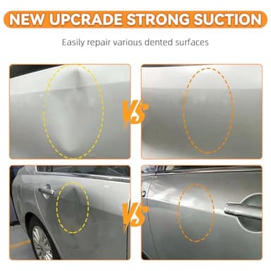 Dent - Image 4