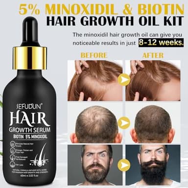 5% Minoxidil Hair Growth Oil for Men and Women - Regrowth Serum, Extra Strength Spray for Hair Loss, Thicker Healthier Hair, Beard Growth Kit, Topical Treatment, 2.02 oz - Image 7
